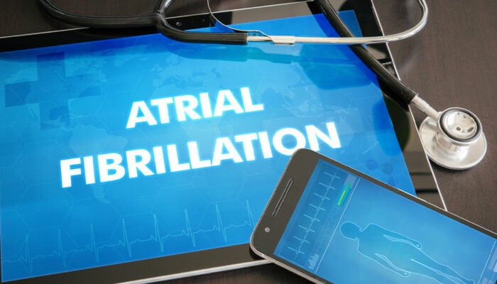 Atrial Fibrillation – Causes, Signs, and Remedies