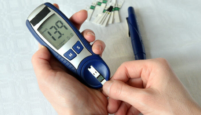 Hyperglycemia – Causes, Symptoms, and Management