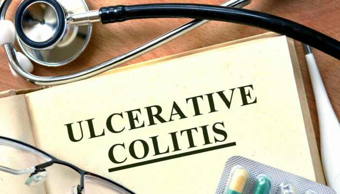 10 Effective Tips for Managing Ulcerative Colitis